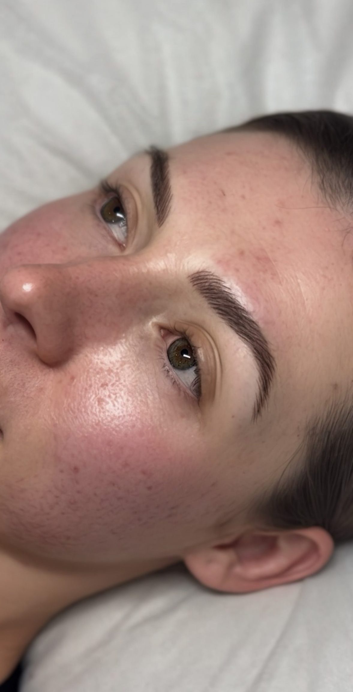 A close-up of a womans face lying on a pillow, showing clear skin with some redness and light freckles, neatly groomed eyebrows, and brown eyes looking upward.