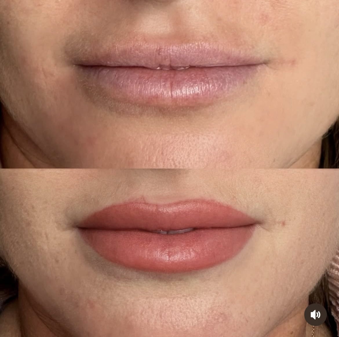 Close-up of lips in two images: the top shows natural, pale lips; the bottom shows the same lips fuller and defined with a reddish-brown tint, suggesting makeup or cosmetic enhancement.